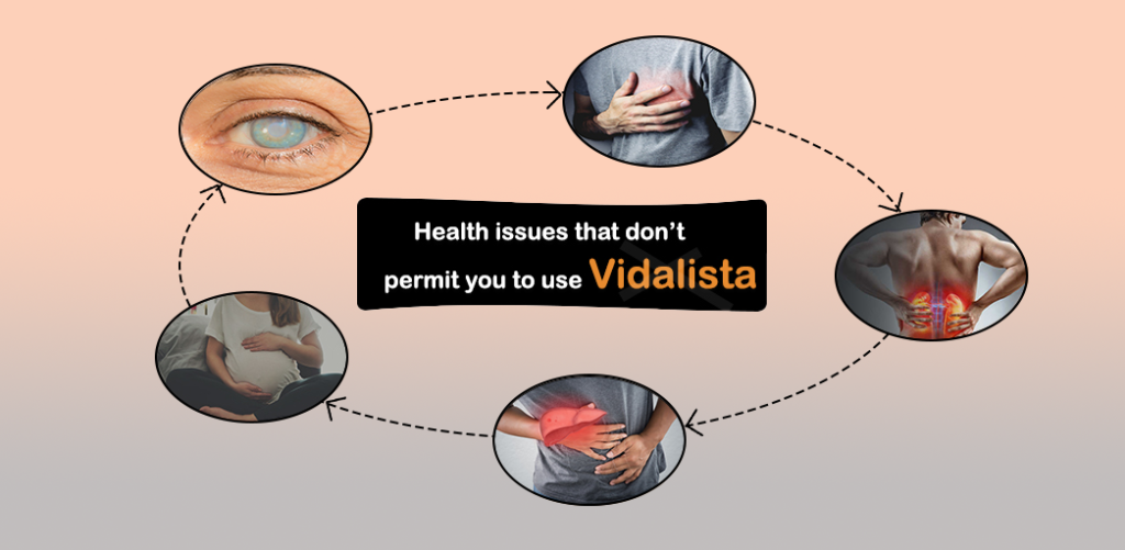 Health Issues that don’t permit you to Use Vidalista